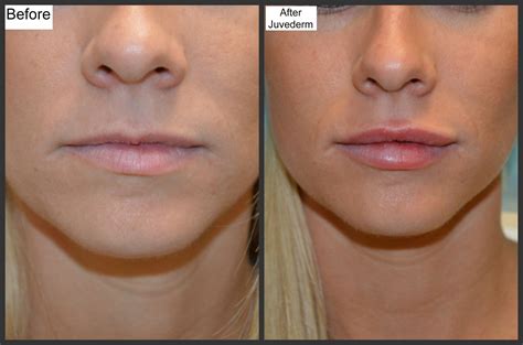 Mastering Lip Line Magic: Tips and Tricks for Perfect Application
